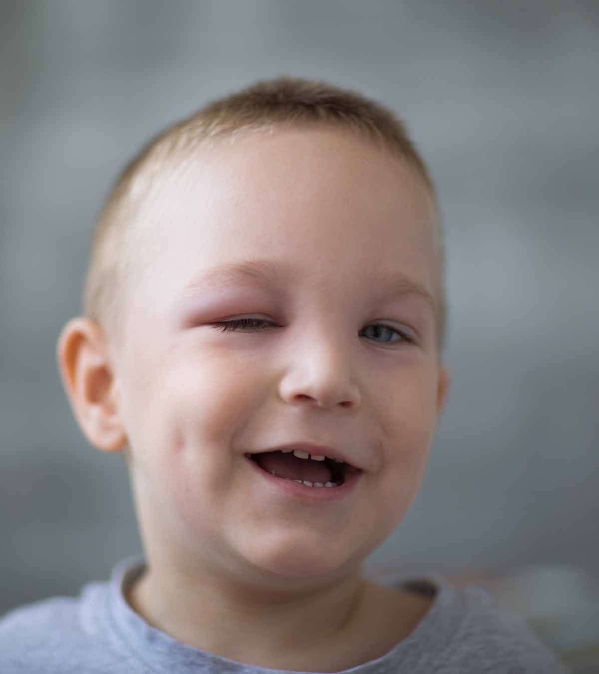 OrthoK Therapy Houston TX